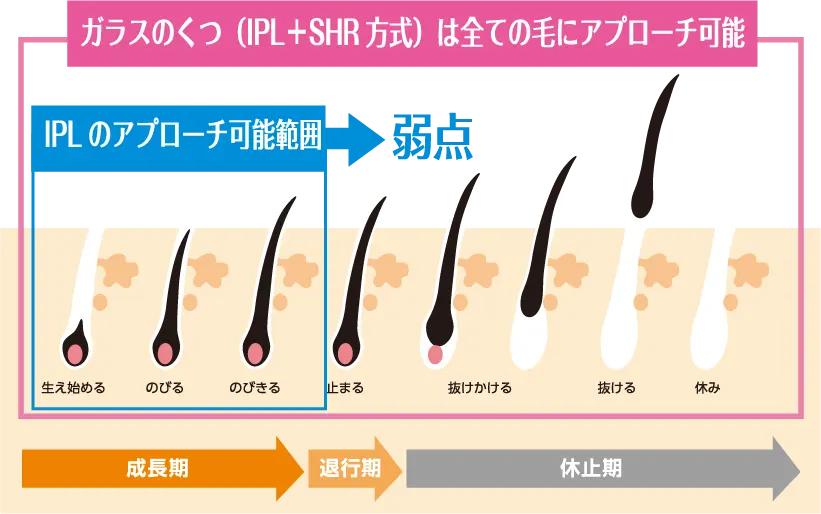 ガラスのくつ（IPL＋SHR方式）は全ての毛にアプローチ可能